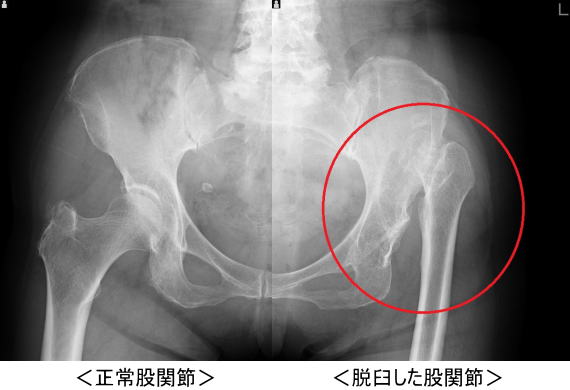 ãè¡é¢ç¯è±è¼ãã®ç»åæ¤ç´¢çµæ