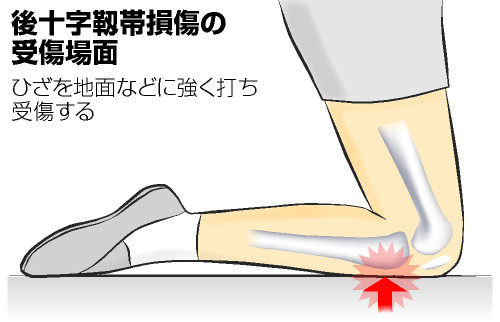 は 靭帯 損傷 と